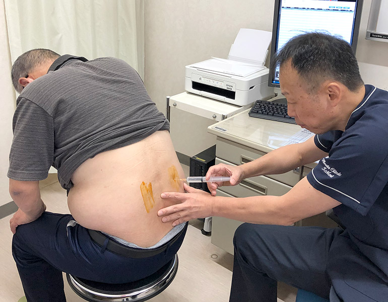 疼痛緩和治療の様子